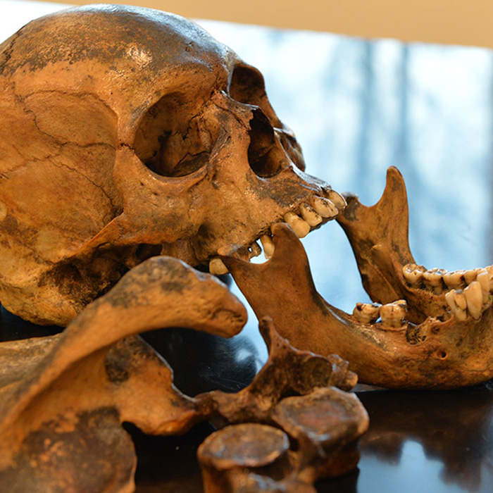 Human skull and bones