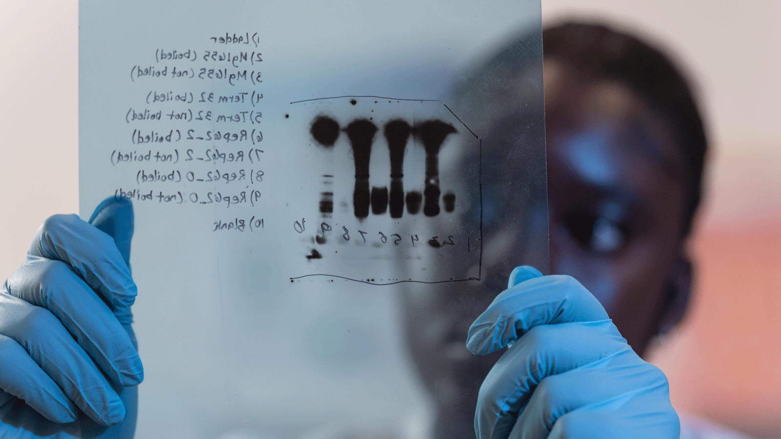 Student observing western blotting sheet
